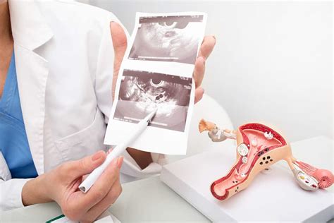 Transvaginal Ultrasound Uses Why Do Women Need It