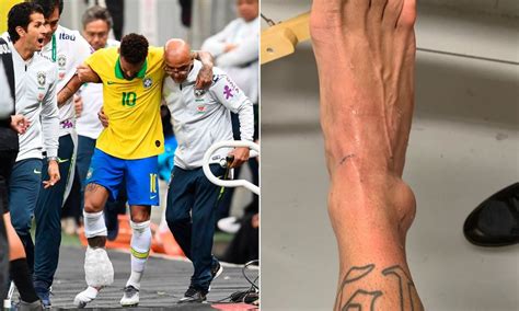 Neymar Ruled Out Of Copa America With Ankle Injury Photos Mandy News