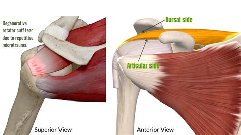 Rotator Cuff Tears Move Better Health And Performance