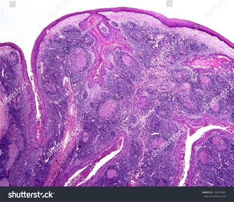 Human Tonsil Seen Light Microscope Low Stock Photo 159810401 Shutterstock