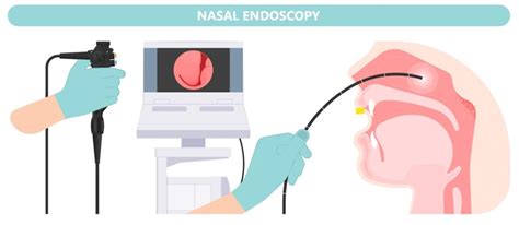 Nasal Endoscopy Tampa Fl Nasal And Sinus Services