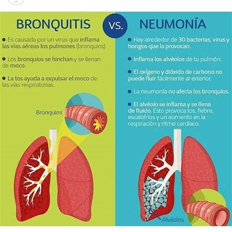 Diferencia Entre Bronquitis Y Neumonia Consultas Medicas Online