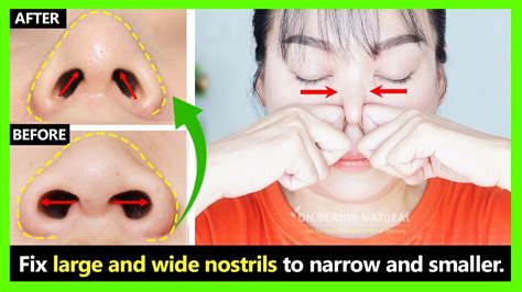 Fast Result How To Fix Big And Wide Nostrils To Be Narrow Smaller With