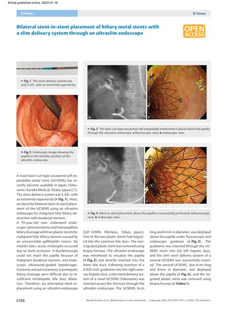 Pdf Bilateral Stent In Stent Placement Of Biliary Metal Stents With A