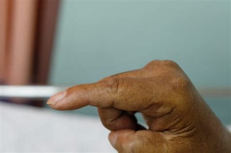 Diseases Your Hands Can Predict Readers Digest