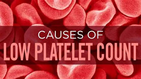 Most Common Cause Of Low Platelet Count Low Platelet Count Causes