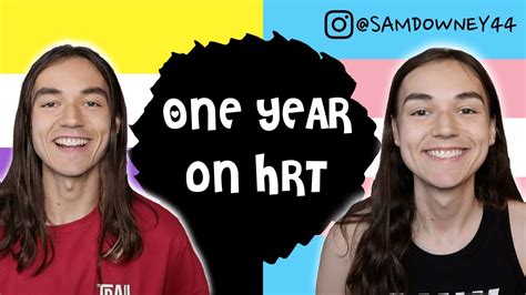 One Year On Hrt Amab To Non Binary Mtf Video Timeline Youtube
