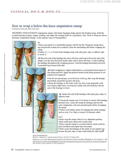 Below The Knee Amputation Artofit