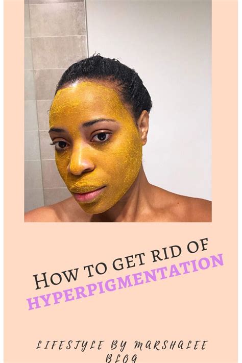 How To Get Rid Of Dark Spots On Your Face And Body Hyperpigmentation