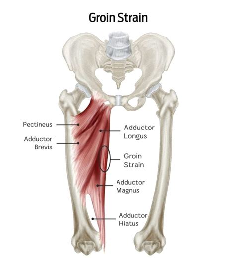 Understanding The Anatomy Of Groin Muscles A Comprehensive Guide