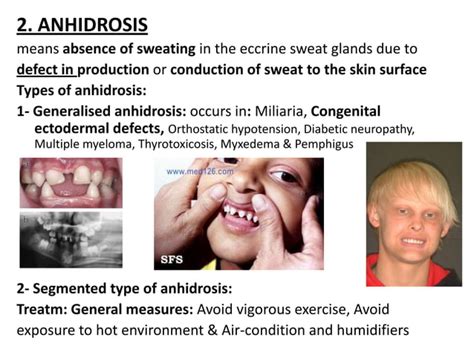 Dermatology Disorders Of Sebaceous And Sweat Glandsdrfaraydwn Ppt