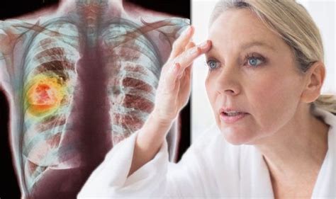 Lung Cancer Symptoms Signs Of Tumour Include Eye Colour Uk