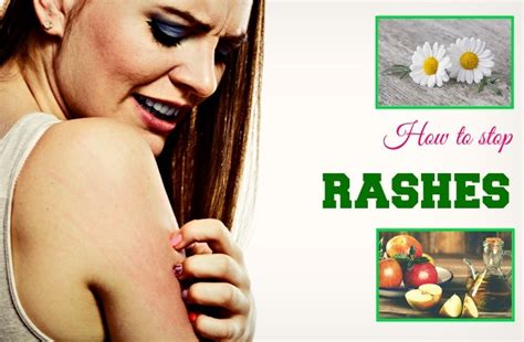18 Tips On How To Stop Rashes From Spreading And Itching