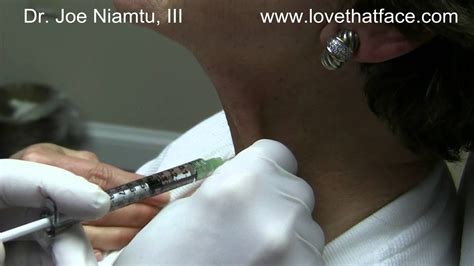 Botox Injection To Neck Bands Platysma Muscle By Dr Joe Niamtu Iii