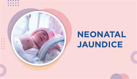 Neonatal Jaundice Motherhood Chaitanya Hospital