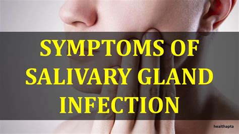 Symptoms Of Salivary Gland Infection Youtube
