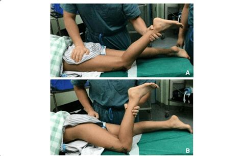 Preoperative Physical Examination When The Hip Was Fixed Knee Flexion