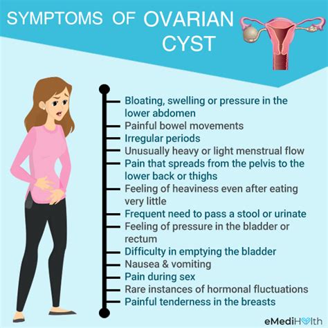 ovary cyst symptoms