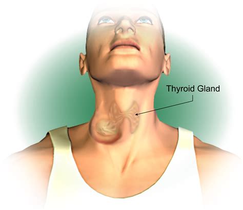 Symptoms Of Thyroid Cancer American Head And Neck Society