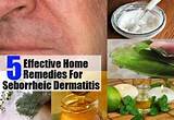 Seborrheic Dermatitis Home Remedies Vinegar Images