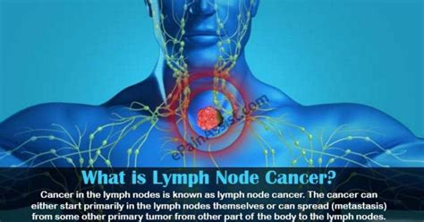 Pancreatic Lymph Nodes