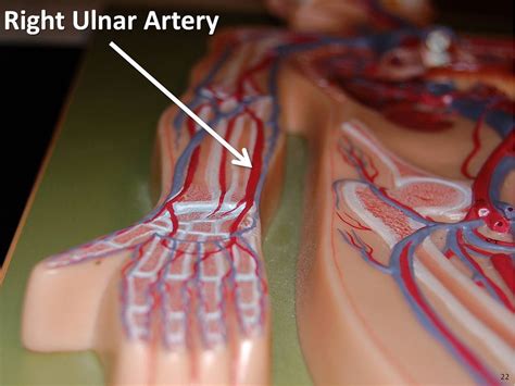 Right Ulnar Artery The Anatomy Of The Arteries Visual Gu Flickr