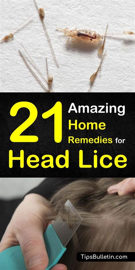Can You Train Our Day Care Workers How You Can Identify Head Lice