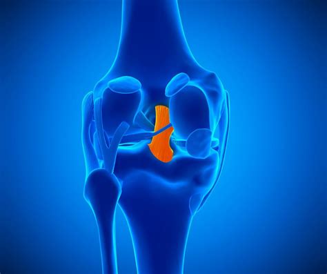 Kneecap Bursitis Knee Pain Osteopathy Clinic Islington London