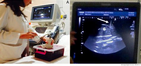 Teaching Innovations In Ultrasound Guided Renal Biopsy Nefrología