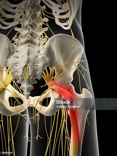 Painful Sciatic Nerve Stock Photo Download Image Now Istock