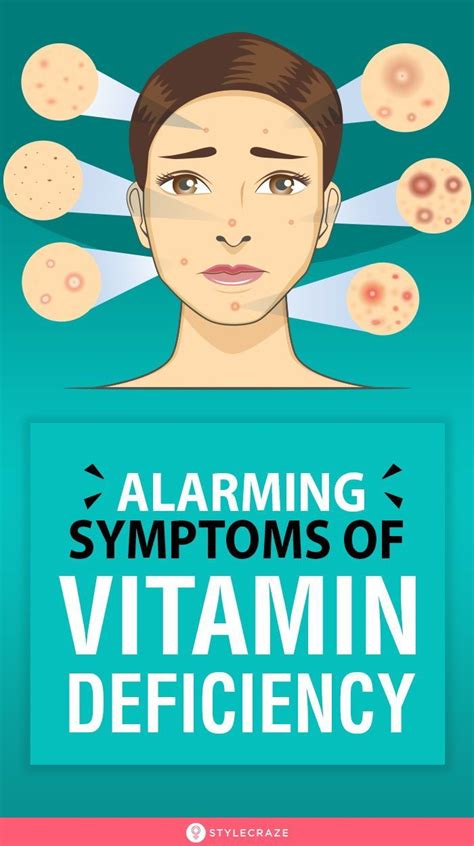 Alarming Symptoms Of Vitamin Deficiency People Usually Tend To Show