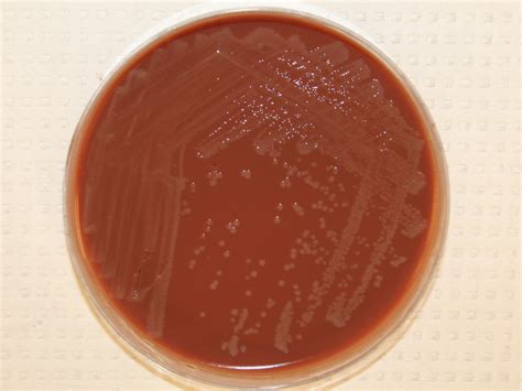 Neisseria Meningitidis Virtual Lab Microbiology