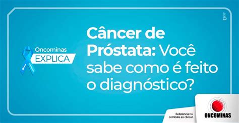 Câncer de Próstata Você sabe como é feito o diagnóstico Oncominas