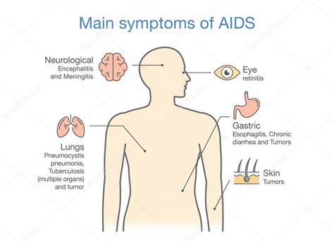 Sintomas Fase Aguda Hiv