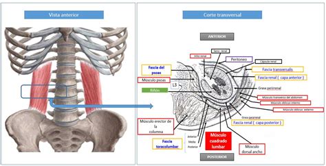 Infiltración Del Músculo Cuadrado Lumbar Dolopedia