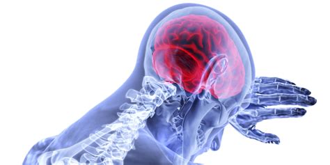 Effective Stroke Drugs Are Saving Nhs Millions Mirage News