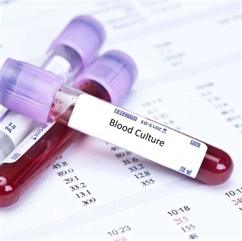 Blood Culture Test Blood Tests In London