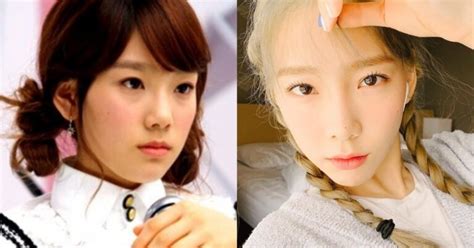 Taeyeon Plastic Surgery Before And After Photos Plastic Surgery Stars