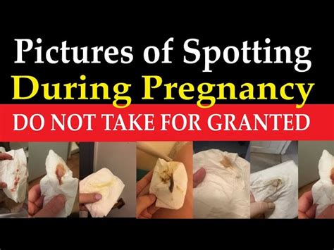What Does Spotting Look Like In Early Pregnancy