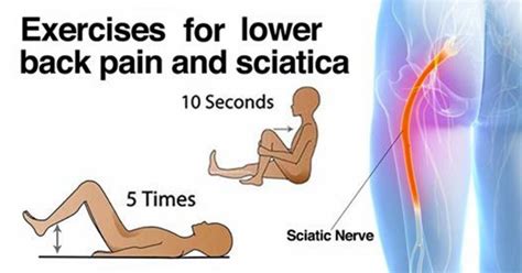 Top 6 Exercises For Sciatica And Lower Back Pain