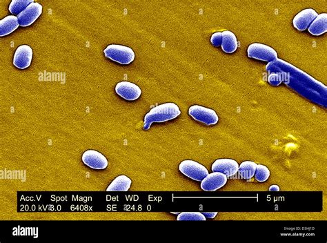 Bacillus Anthrax Fotos Und Bildmaterial In Hoher Auflösung Seite 2 Alamy