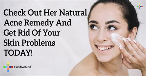 Check Out Her Natural Acne Remedy And Get Rid Of Your Skin Problems