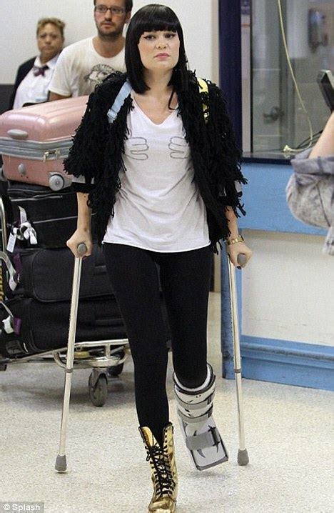 Jessie Js Stalker Fan Broke Her Own Leg To Be Like Singer Daily