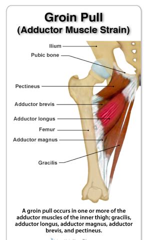 Hamstring muscles power walking and other movements because they are located at the back of your thigh. Groin and Adductor Strains In Ultimate Players: Why It ...