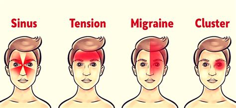 4 Most Usual Types of Headaches (What They Indicate About Your Health