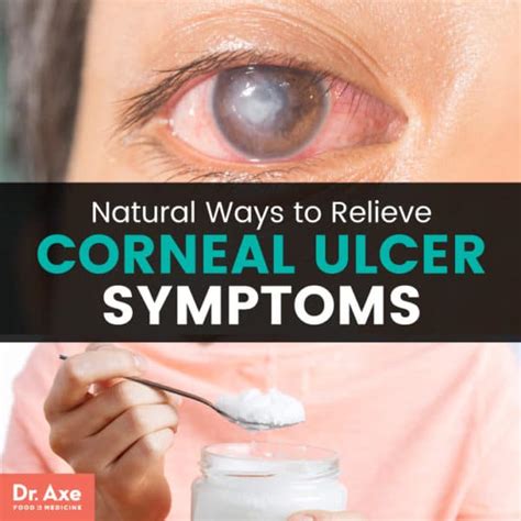 Corneal Ulcer Symptoms Relieve Symptoms 11 Natural Ways Dr Axe