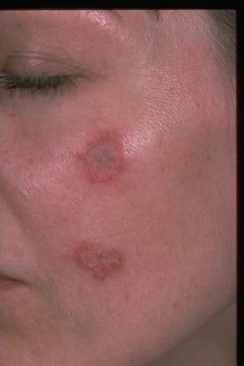 Quotes About Skin Disease 29 Quotes