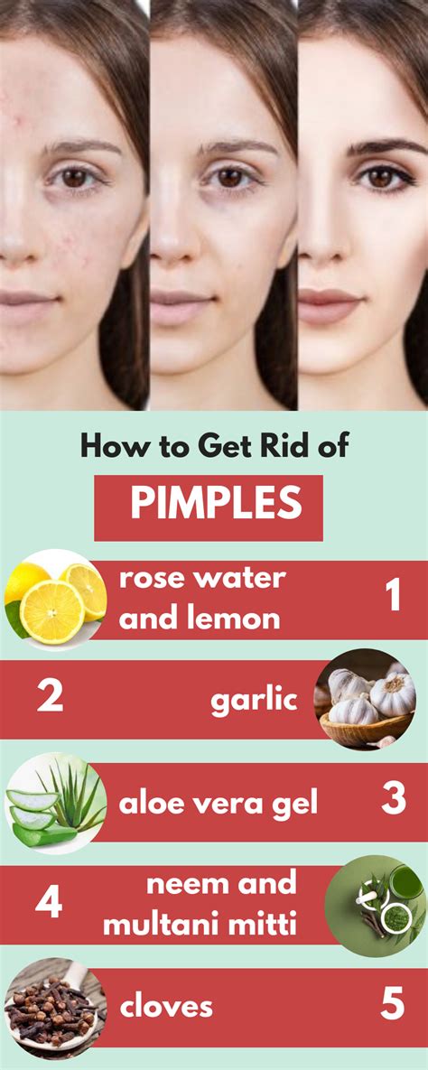 Quick Way To Reduce Pimple Redness Anna Blog