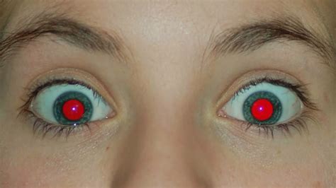 What Causes Red Eye In Photos Youtube