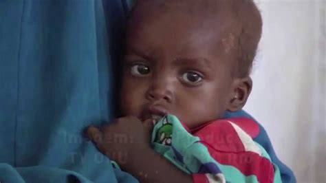 Somália 200 Mil Crianças Sofrem De Desnutrição Aguda Youtube